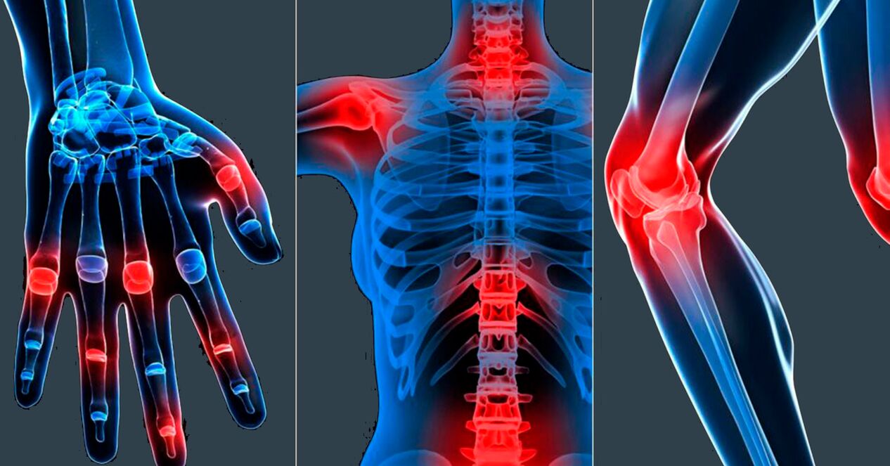 Hinweise zur Verwendung von Boswellia-Extrakt in Kapseln.